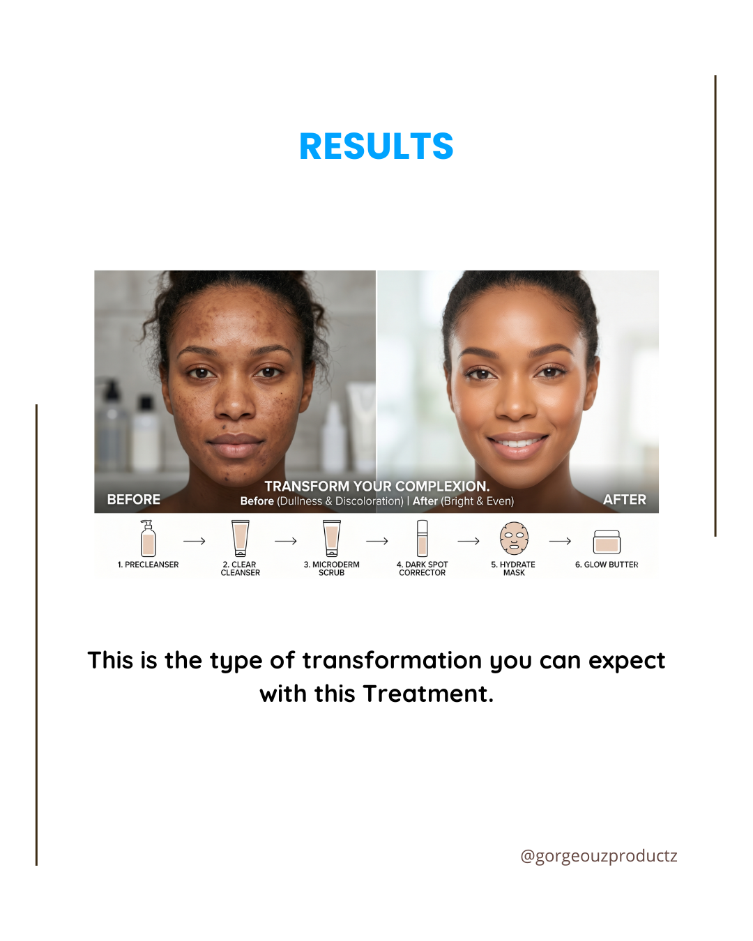 GORGEOUZ NORMAL SKIN WITH MINOR DISCOLORATION TREATMENT